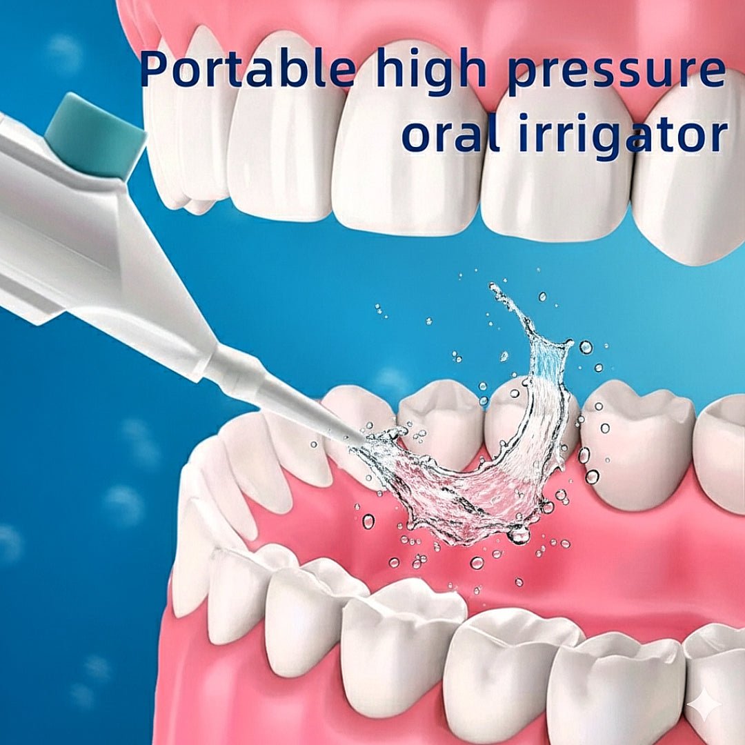 High - Pressure Portable Oral Irrigator Effectively removes food residue and plaque using powerful water pressure. Manual, easy to use, and perfect for deep teeth and gum cleaning at home or on the go. - VELORA