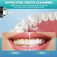 Say Goodbye to Dentist Visits! Portable Oral Irrigator for a Perfect Smile - VELORA
